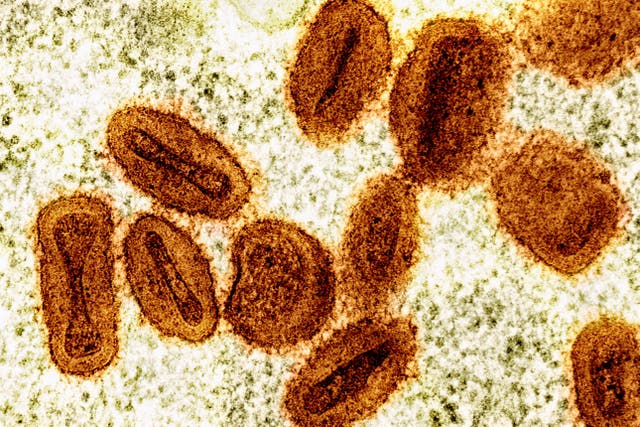 <p>This electron microscope image provided by the National Institute of Allergy and Infectious Diseases in 2024 shows Mpox virus particles, orange, found within infected cells, green</p>